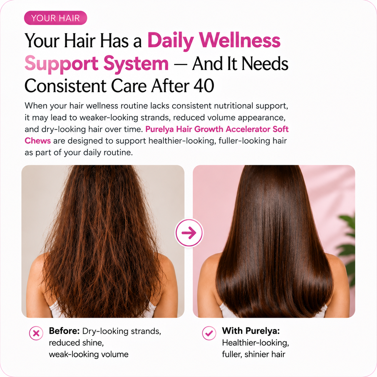Hair Growth Accelerator Soft Chews
