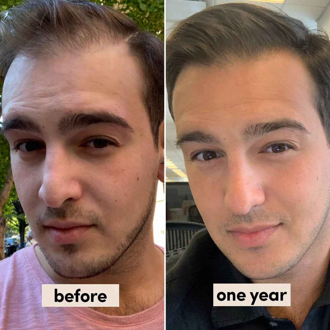 Hair Growth Rosemary & Peppermint Serum™