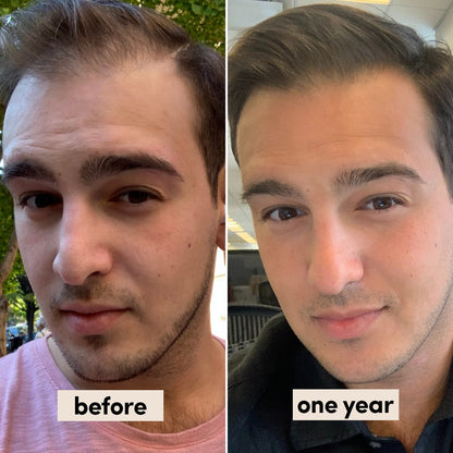 Hair Growth Rosemary & Peppermint Serum™