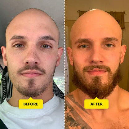 Hair Growth Serum Roll-on Face