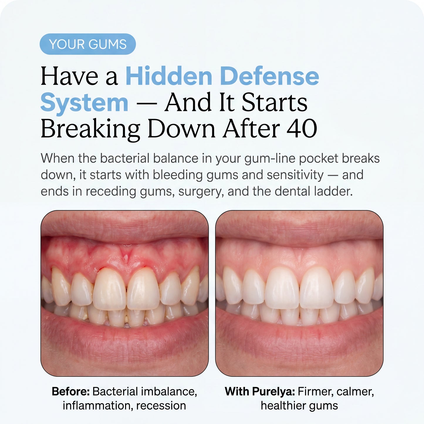 Oral Health Chews.