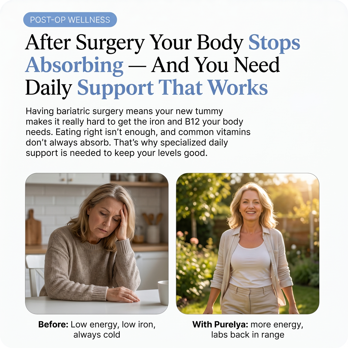 Bariatric Multivitamin — Once-Daily with 45mg Iron (V2)